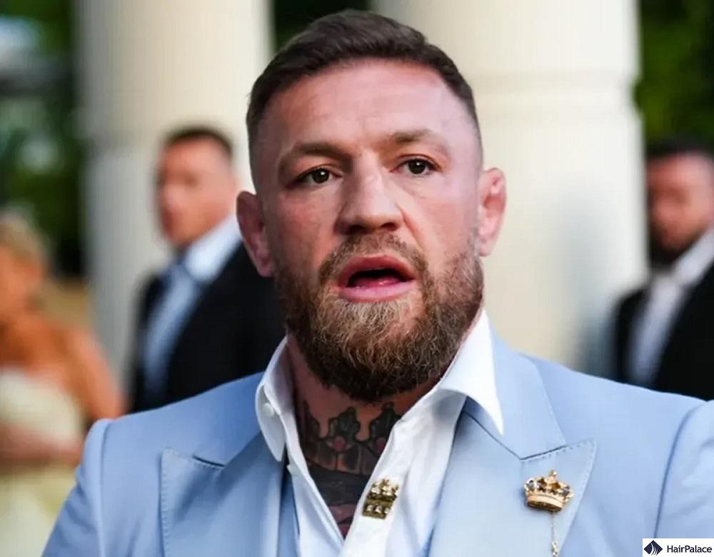 mcgregor hair transplant resultss look outstanding