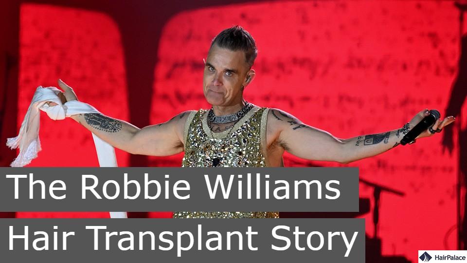 the robbie williams hair transplant story