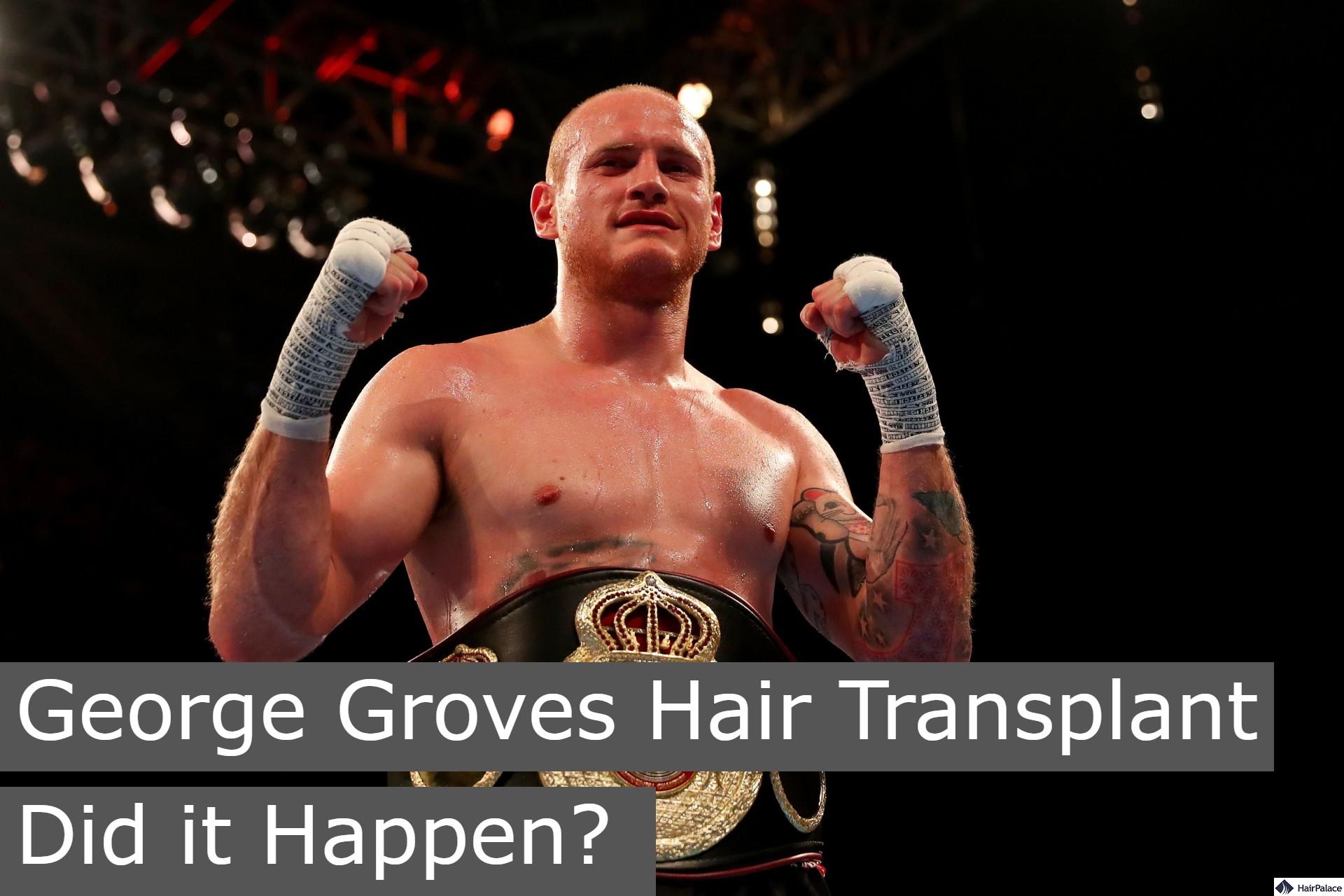 george groves hair transplant did it happen