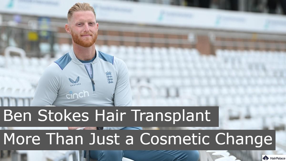 Ben Stokes Hair Transplant More Than Just a Cosmetic Change