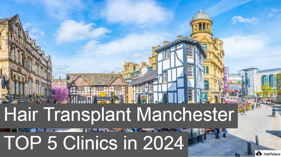 hair transplant manchester top 5 clinics in 2024