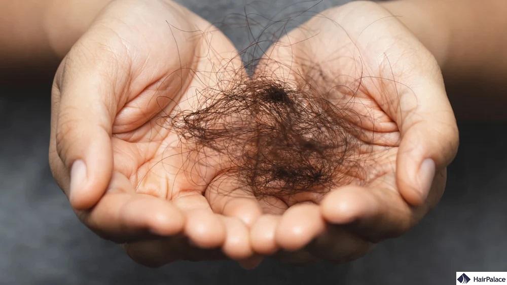 signs of seasonal hair loss