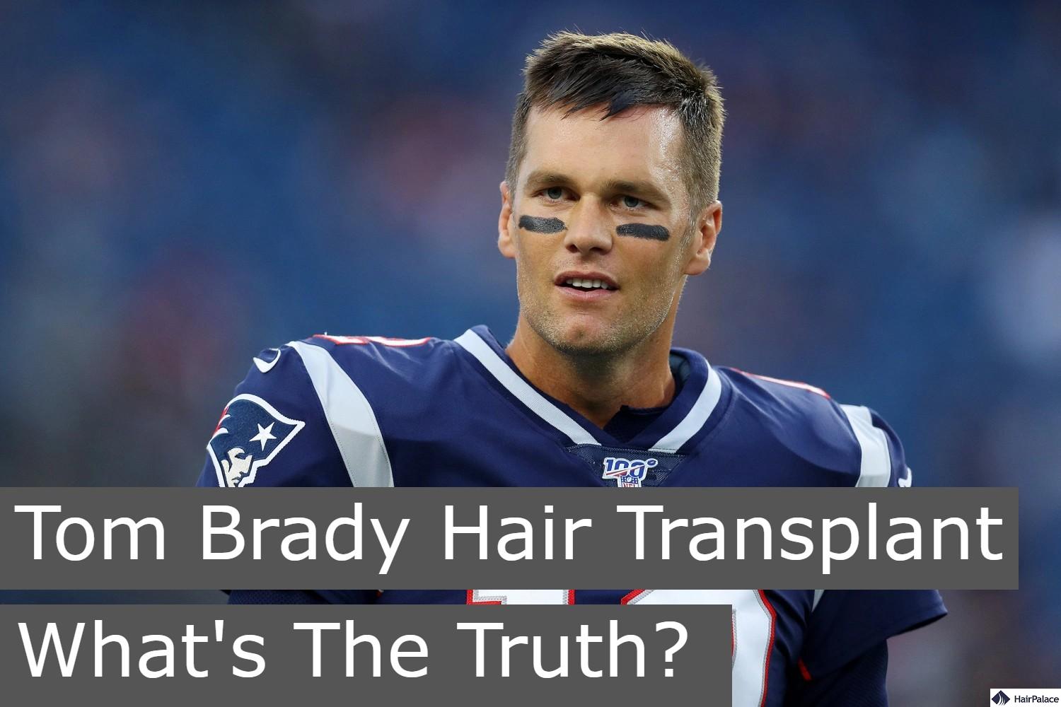 tom brady hair transplant what's the truth