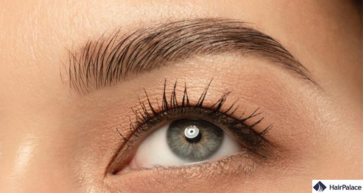 eyebrow hair transplant is a popular treatment