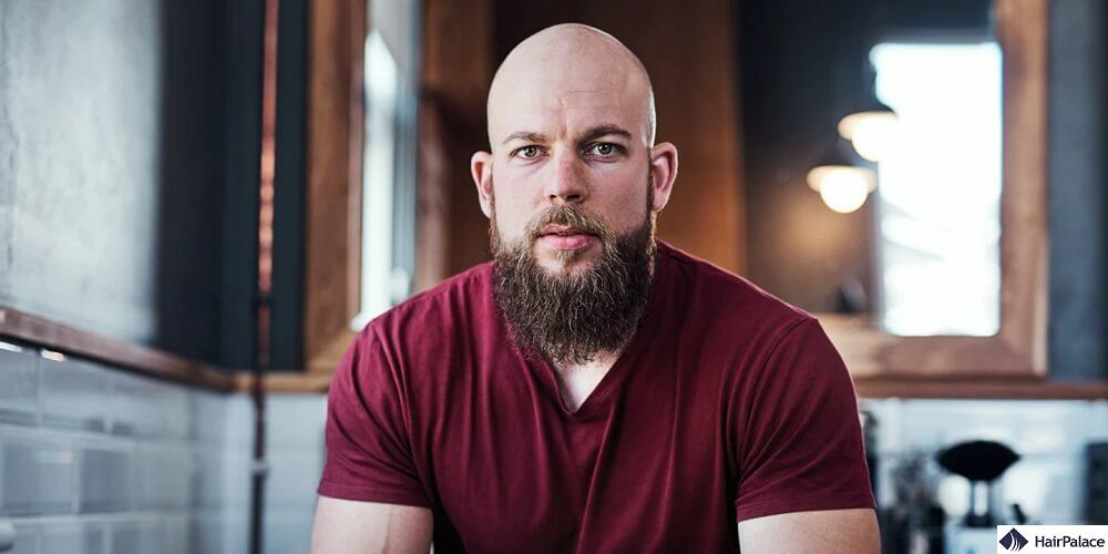 baldness cure, does it exist?