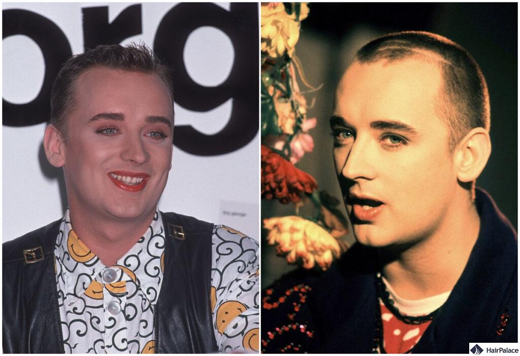 boy george receding hairline in his 20s