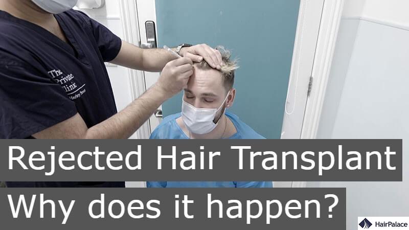 rejected hair transplant