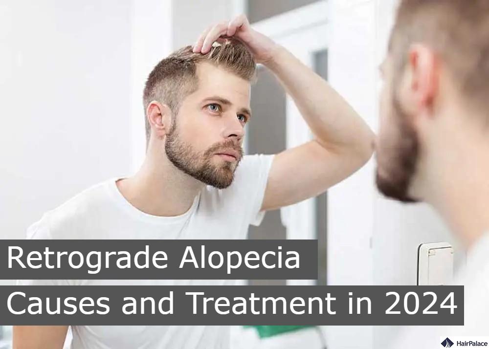 retrogade alopacia causes and treatment in 2024