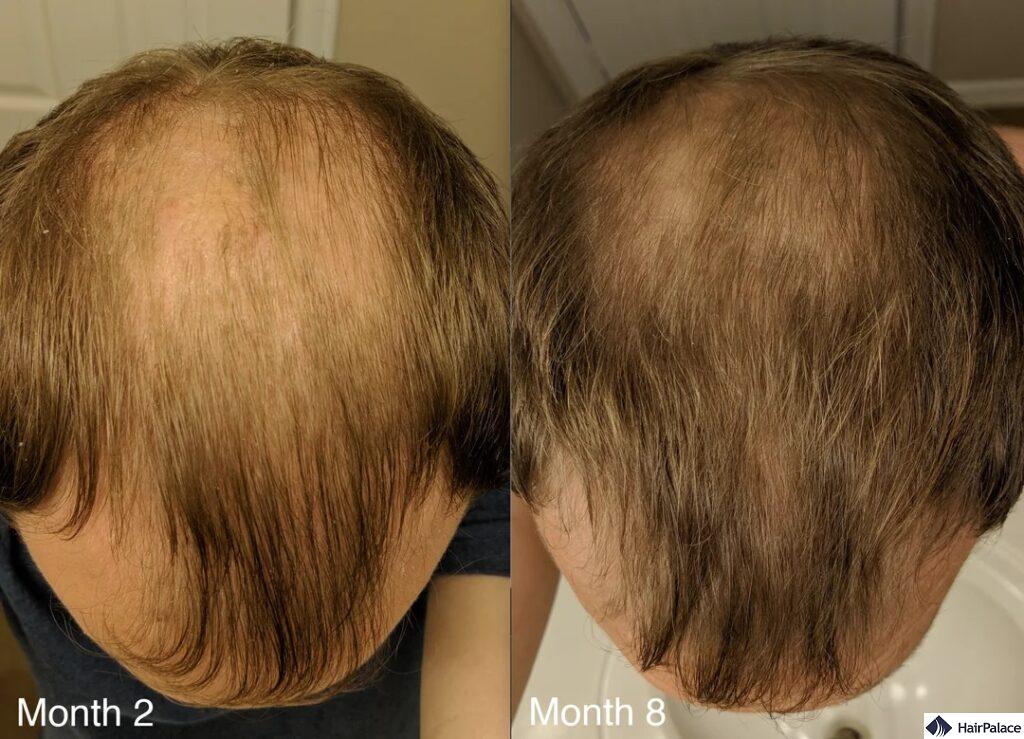 scalp massage before and after