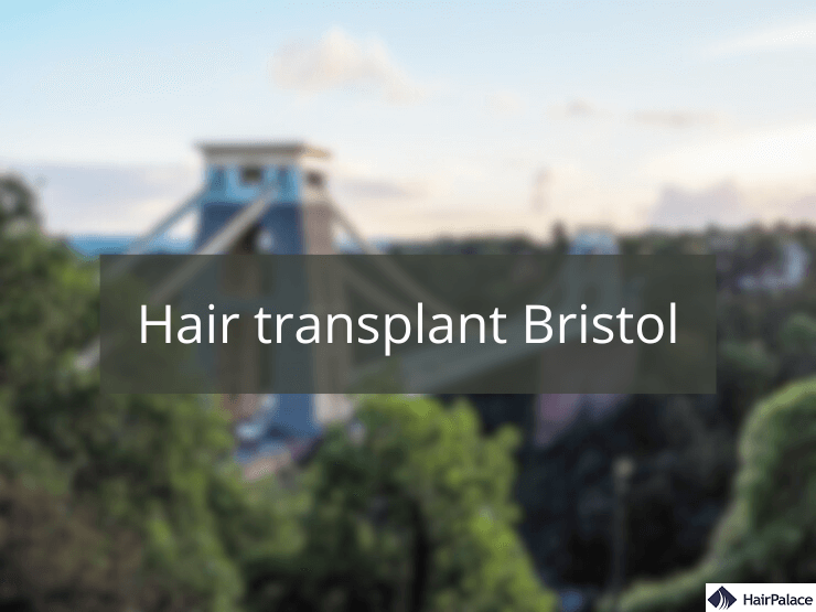 hair transplant bristol