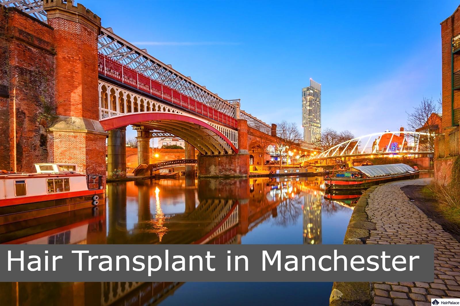 hair transplant in manchester
