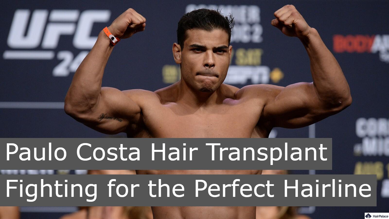 paulo costa hair transplant fighting for the perfect hairline