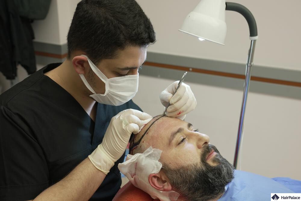 dhi hair transplant procedure
