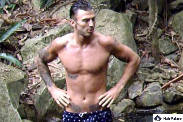 jake quickenden with a receding hairline