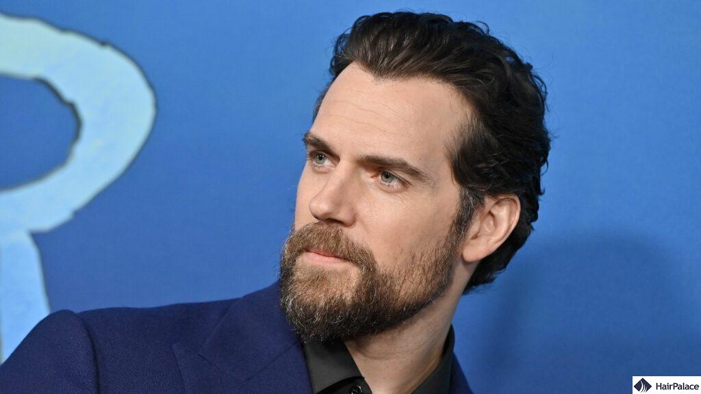 henry cavill hair loss