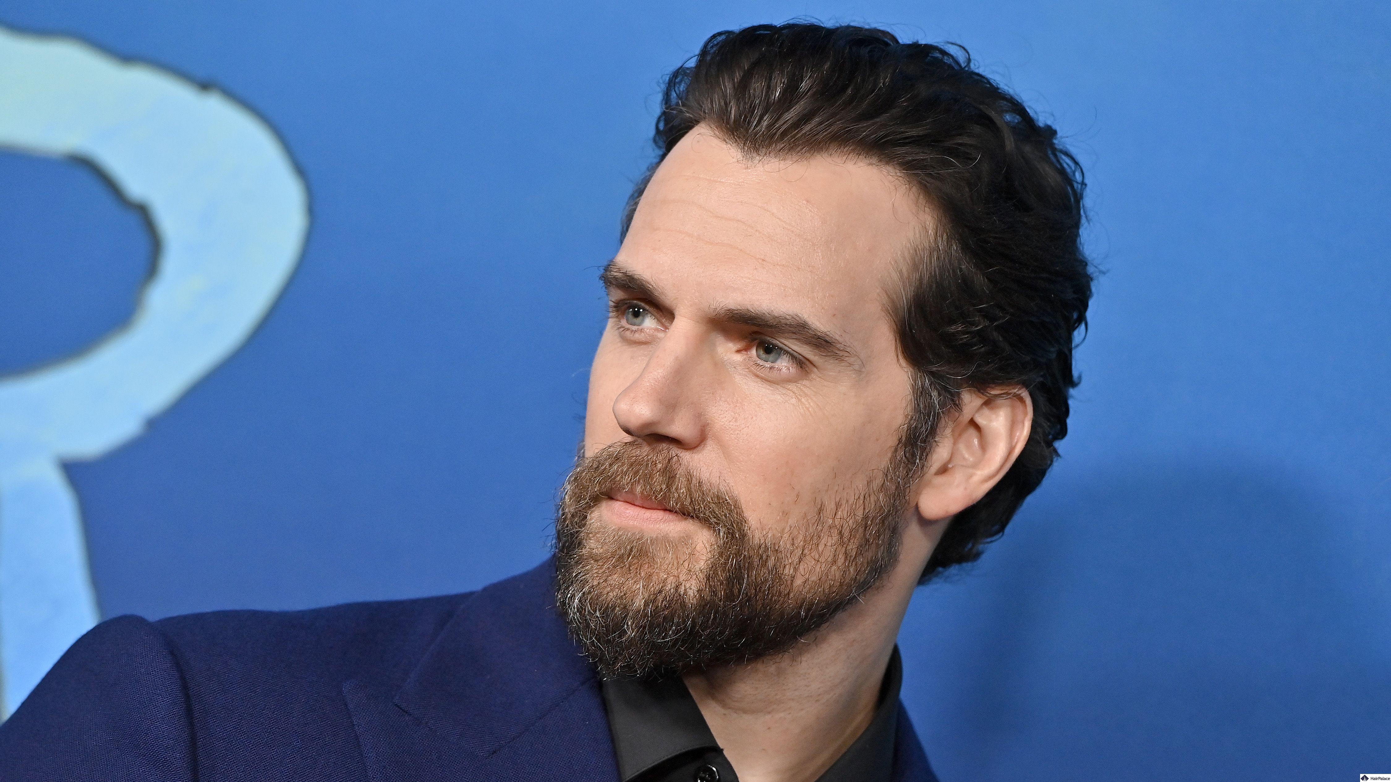henry cavill hair loss