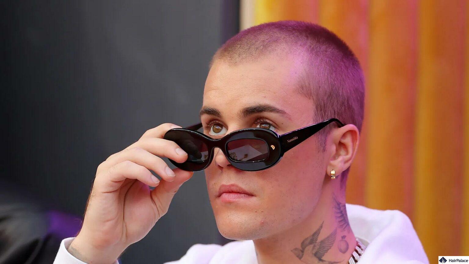 Justin Bieber Hair Transplant Procedure What is The Truth?