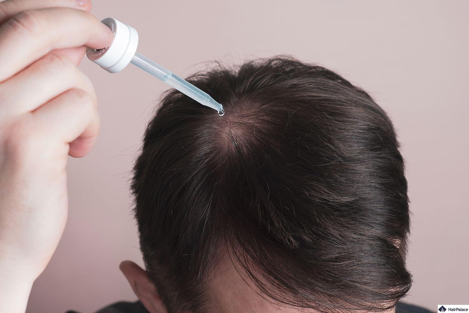 Minoxidil 10 Percent: Is This The Best Dosage?