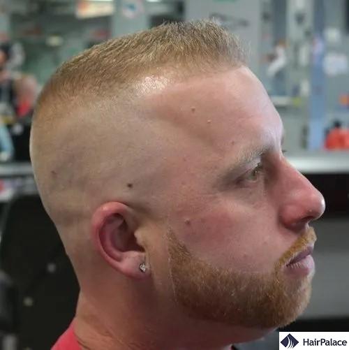 high and tight receding hairline haircuts
