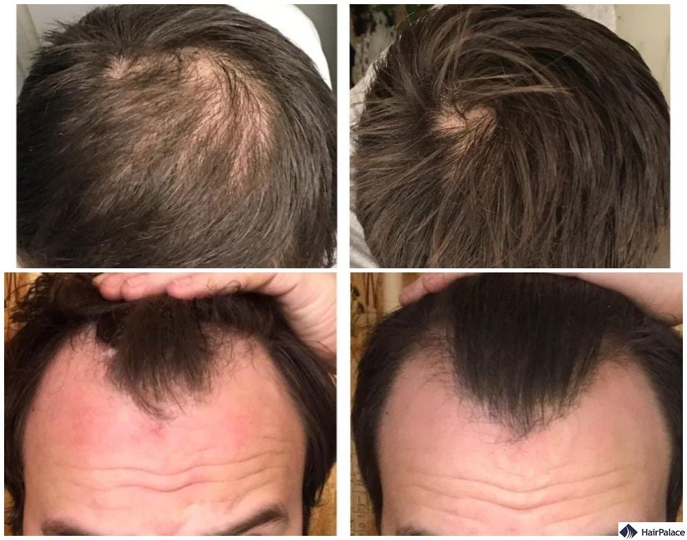 Stemoxydine results